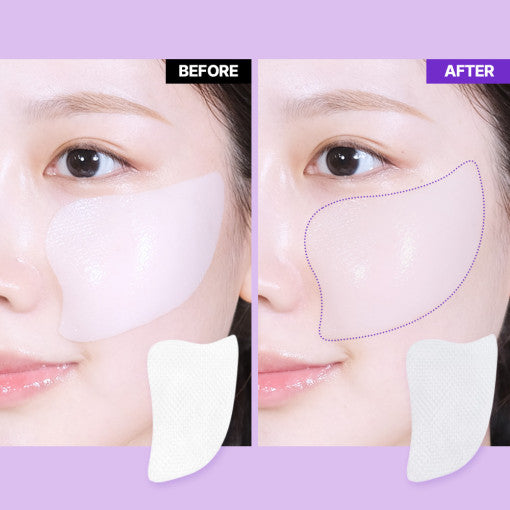 [bio Heal Boh] Probioderm 3d Lifting Voluming Patch 4 + 1 – The Glow ...
